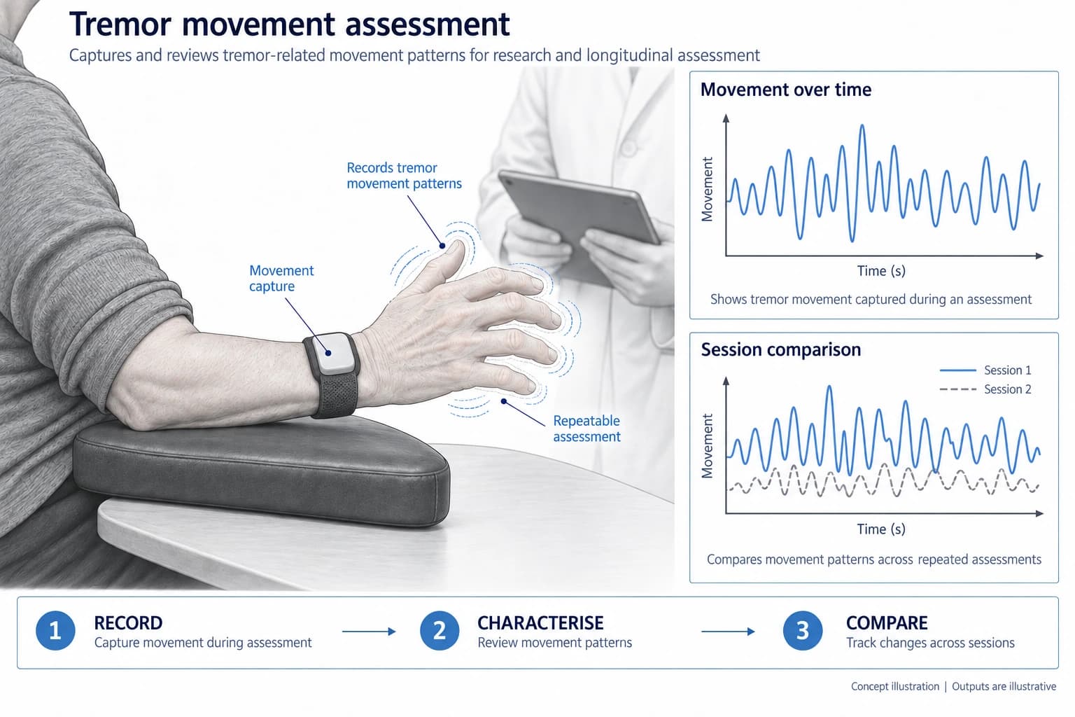 Technical concept illustration showing the functions and outputs of Tremor Identification Device for Parkinson’s Disease